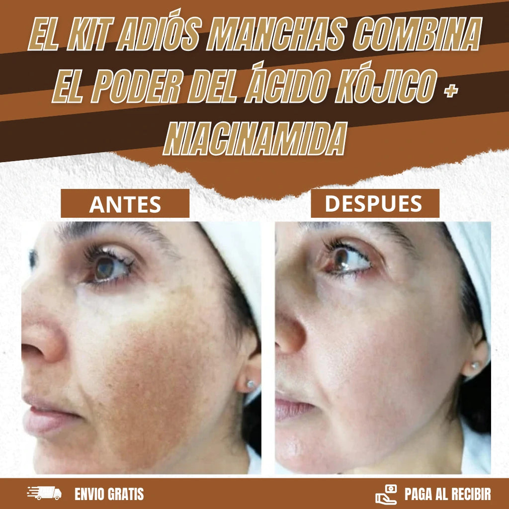 KIT JABON + SERUM + MASCARILLA CON ACIDO KOJICO Y NIACINAMIDA B3